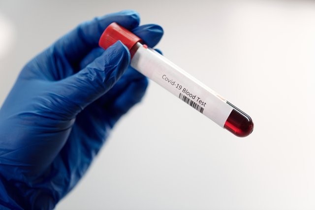 Rus Büyükelçiliği'nden aşı ve PCR testi açıklaması